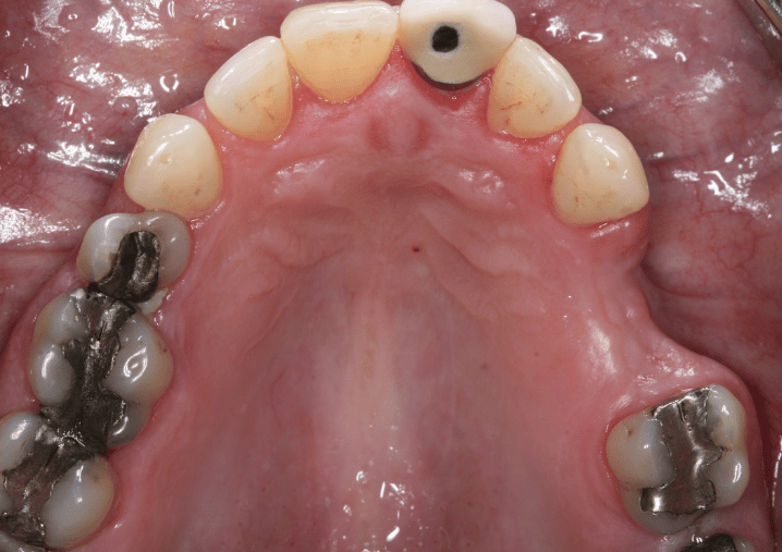 Before - Colindale Dental